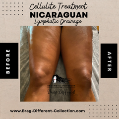 Nicaraguan Lymphatic Drainage & Postop Care Services